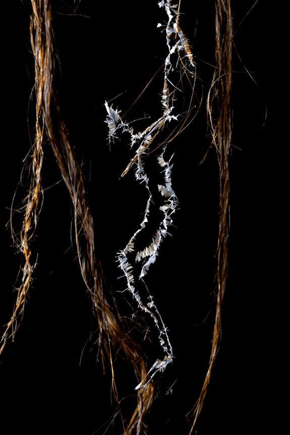 hair restoration recovery strategies
